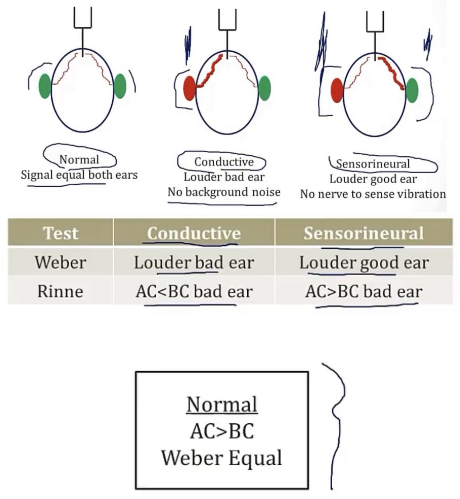 <p>-hearing</p><p>-tuning fork; on the bridge of the forehead</p><p>-equal</p><p>-bad</p><p>-good</p>