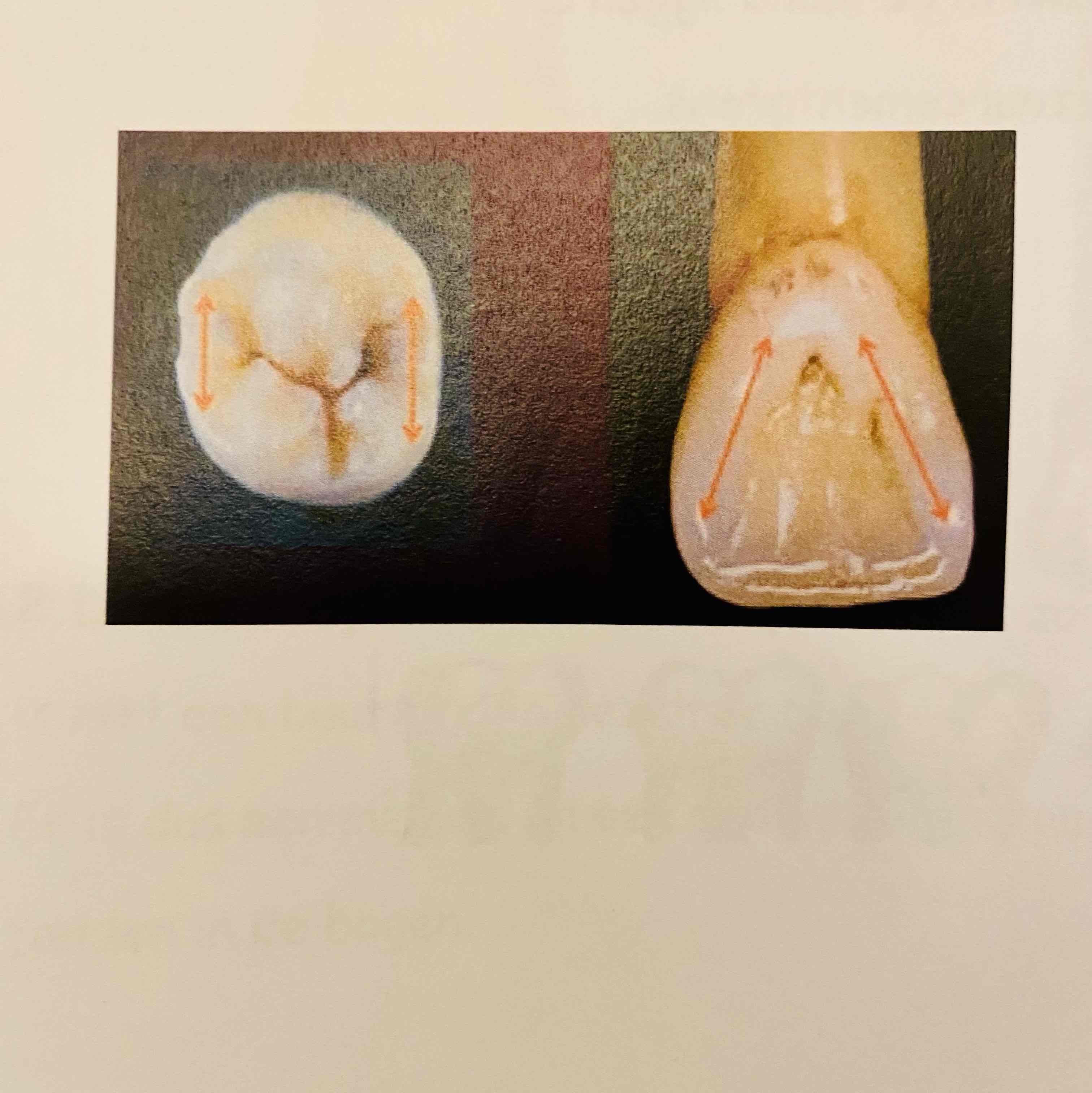 <p>Wat is de marginale kam?</p>