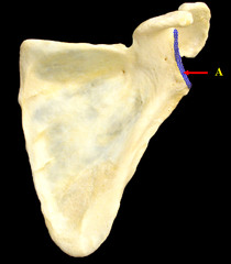 <p>indentation on scapula for humerus. Common site of dislocation.</p>