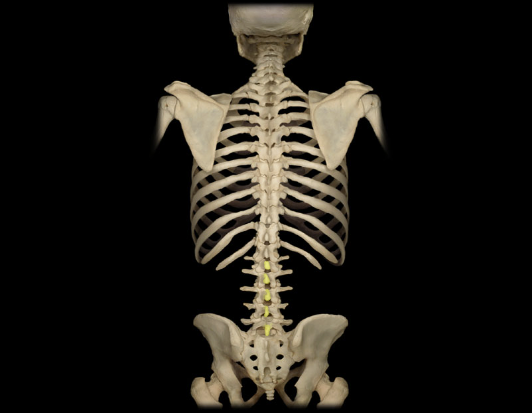 <p>Spinous process of lumbar vertebra</p>