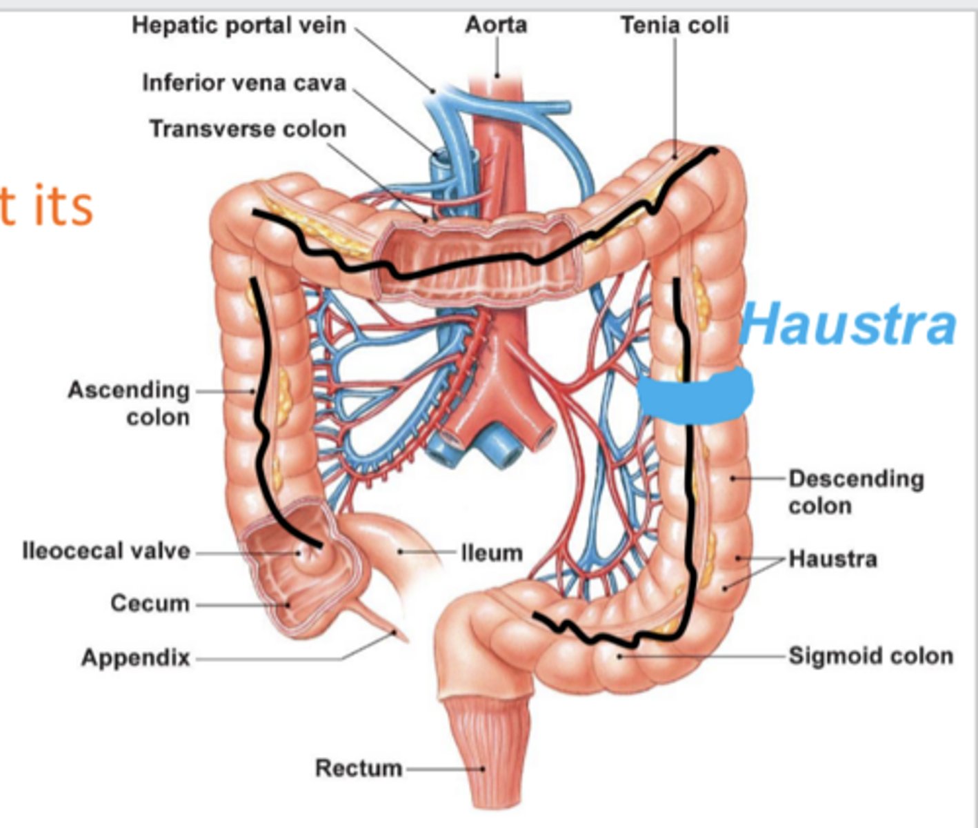 <p>describe the structures that make up the large intestine in order (from closest to small intestine to end)</p>