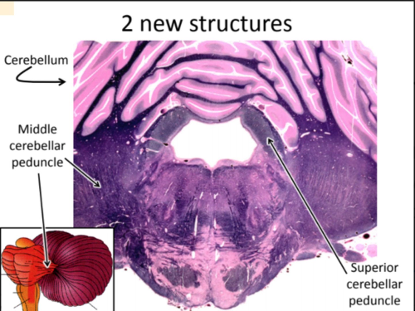 <p>- Cerebellum: attached to pons mainly via middle cerebellar peduncle, which is composed of fibers from the pontine nuclei that have crossed the midline - their axons synapse in the cerebellum<br>- Superior Cerebellar Peduncle: composed mostly of fibers originating in the cerebellum and projecting to the rostral midbrain and the thalamus</p>