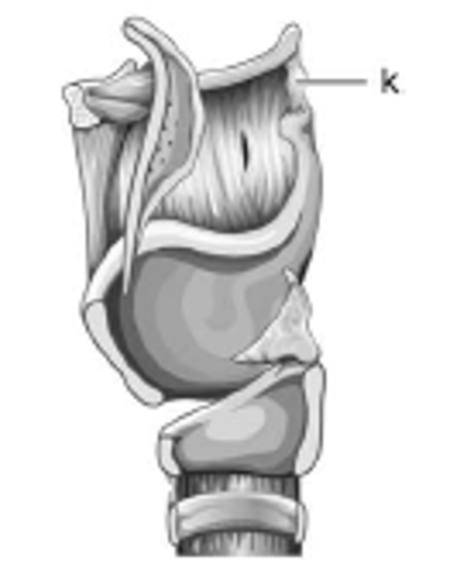 <p>label k -&nbsp;is it extrinsic or intrinsic?</p>