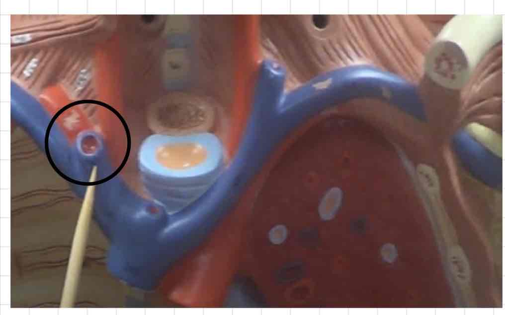 <p>what is this? (torso model)</p>
