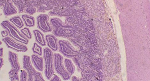 <p>What is the histology?</p>