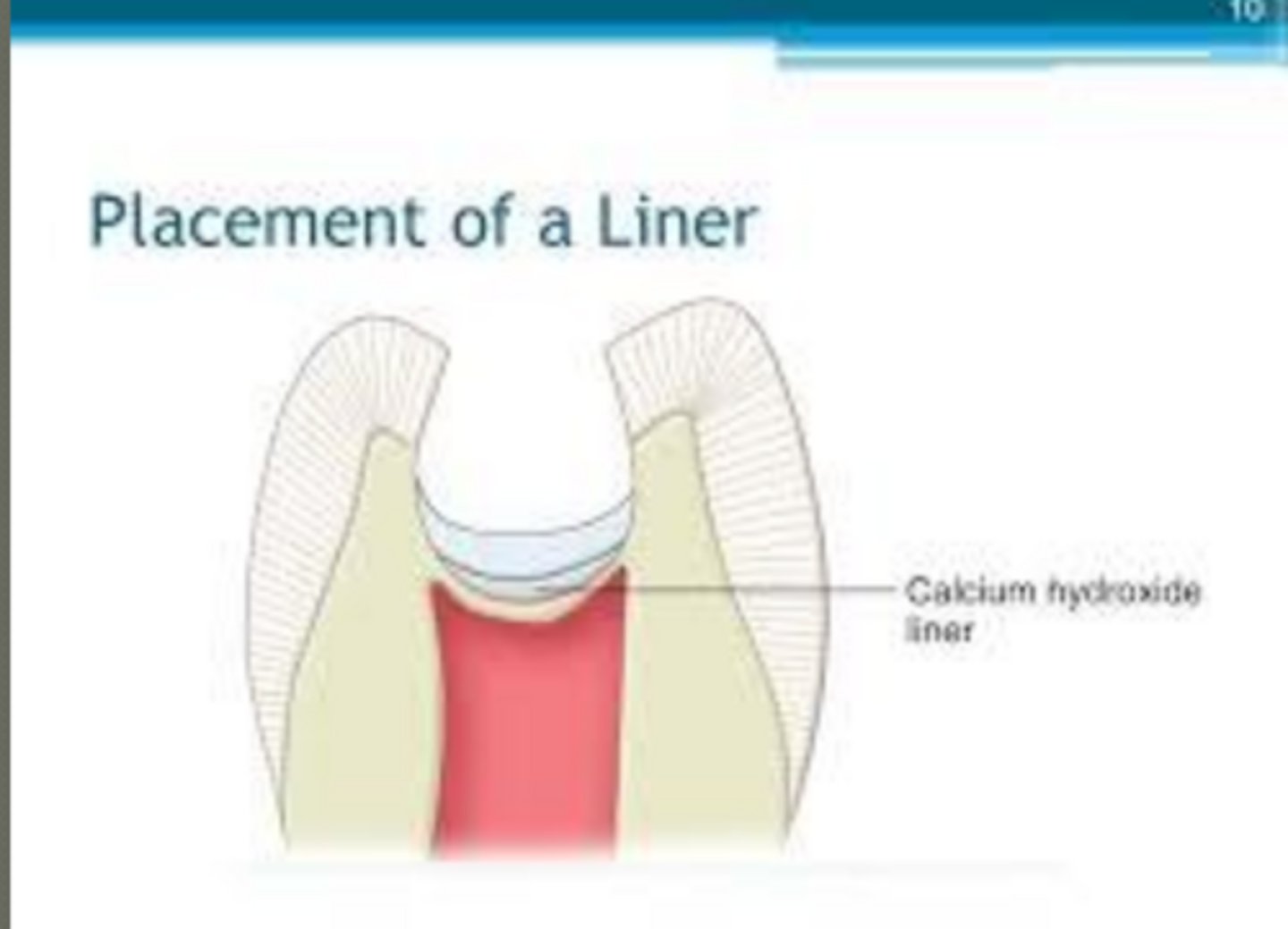 <p>thickness</p><p>*most important consideration for pulpal protection... thickness of remaining dentin when choosing liners and/or base*</p>