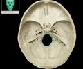 <p>A large opening at the base of the skull through which the brain connects to the spinal cord.</p>