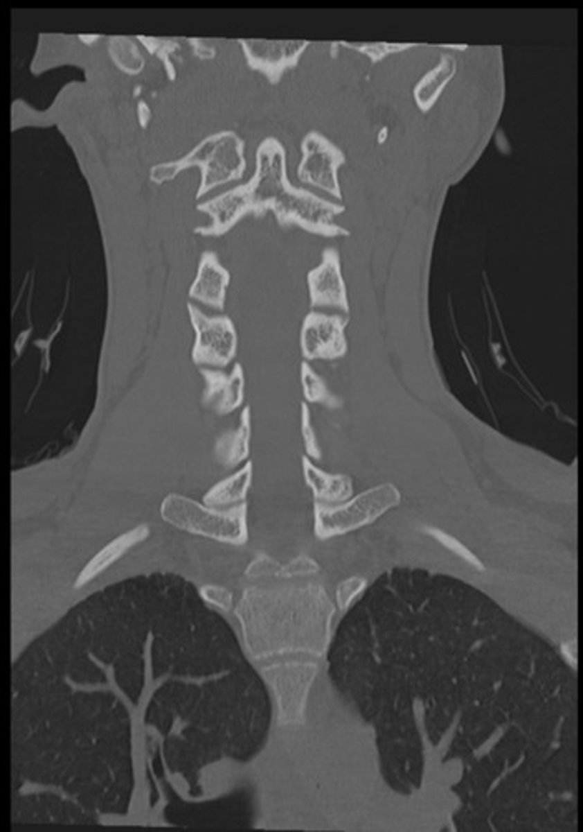 <p>What plane is this?</p>