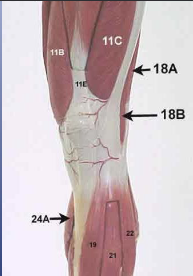 <p>What muscle is this? (<strong>19) </strong>*****</p>