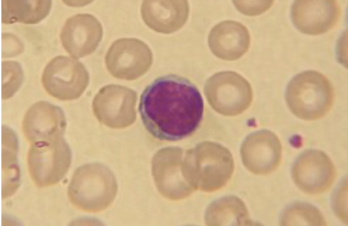 <p>what is the function of the lymphocytes (part of the leukocytes)&nbsp;</p>