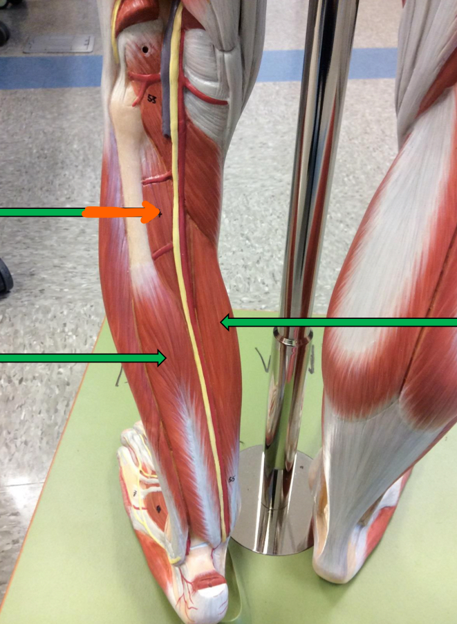 <p>Identify this muscle?</p>