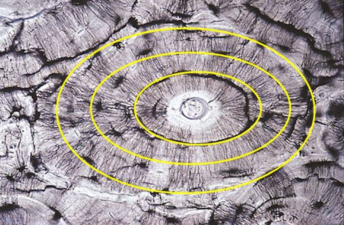 <p>cylinder-shaped layers of calcified matrix around the central canal. rich in collagen</p>