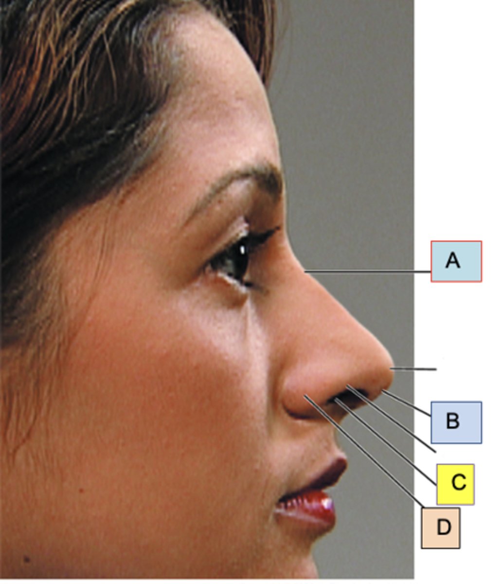 <p>ID D</p>