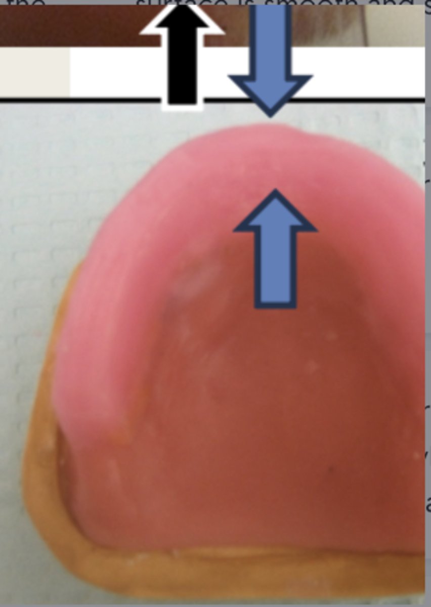 <p>How wide is the incisal plane at the anterior portion of the maxillary wax rim?</p>