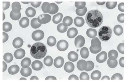 <p>The photograph below shows a blood smear.</p><p> List the cells that are visible in the smear. (2)</p>