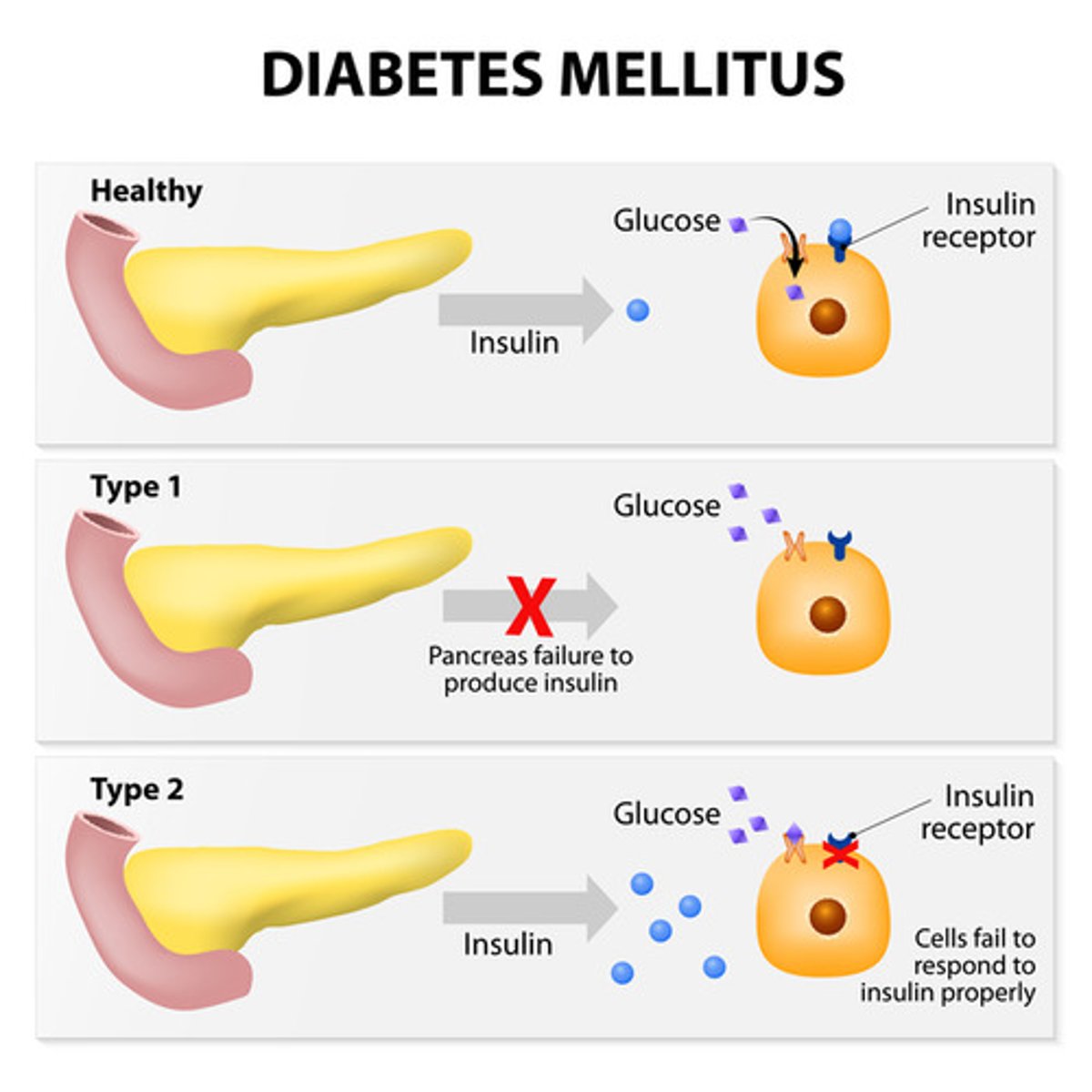 <p>(A) Type I, Type II</p><p>Because treatment with insulin is the only effective treatment for Type I Diabetes, it is called Insulin-Dependent. Type II Diabetes can be treated also with drugs to re-sensitize the insulin receptors or increase insulin production, making it non-insulin dependent.</p>