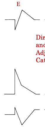 <p>initially: heart rate dec, systolic and diastolic BP increase</p><ul><li><p>same initial response as NE bc activation of alpha receptors &amp; baroreceptor reflex </p></li></ul><p>then: heart rate increases, systolic and diastolic bp decrease </p><ul><li><p>beta 2 receptors causes vasodilation —&gt; decreased diastolic BP</p></li><li><p>beta 1 receptors —&gt; increase heart rate </p></li></ul><p>returns back to baseline </p>