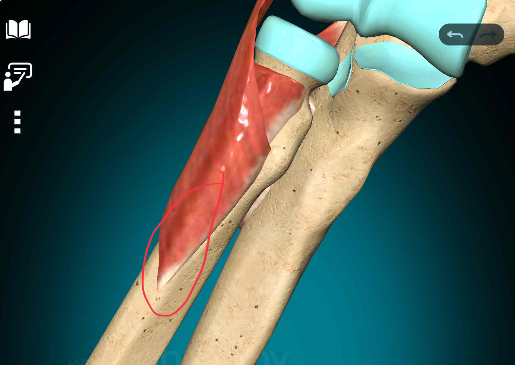 <p>Supinator Insertion</p>