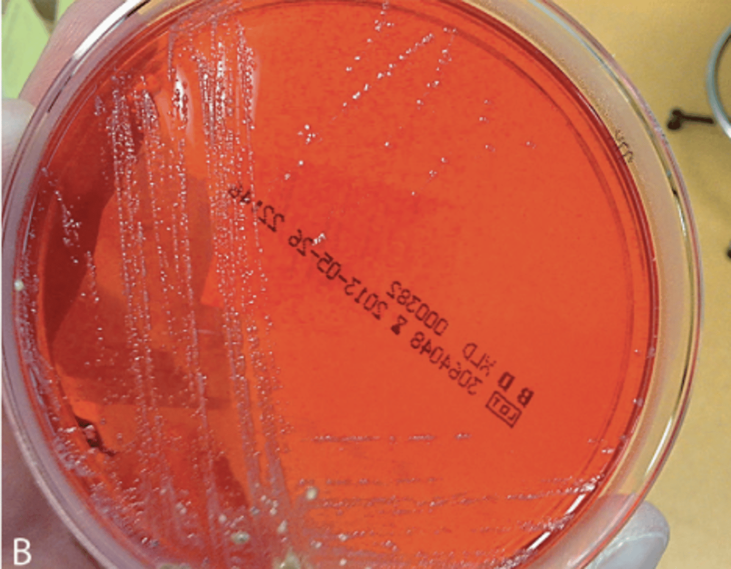 <p>Milieu : SS</p><p>Respiratoire : AAF</p><p>Température : 37 degrés</p><p>Délai : 24h</p><p>Aspect : Colonies de 2-3mm, rondes, à bords réguliers, brillantes </p>