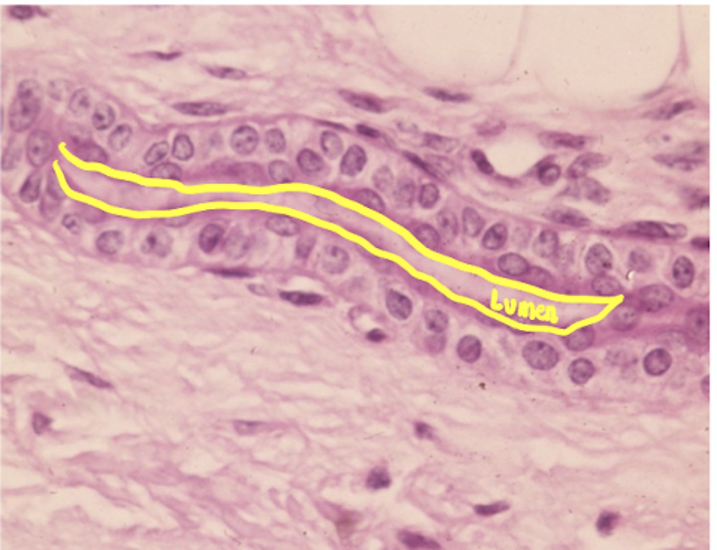 <p>what type of epithelium is shown</p>