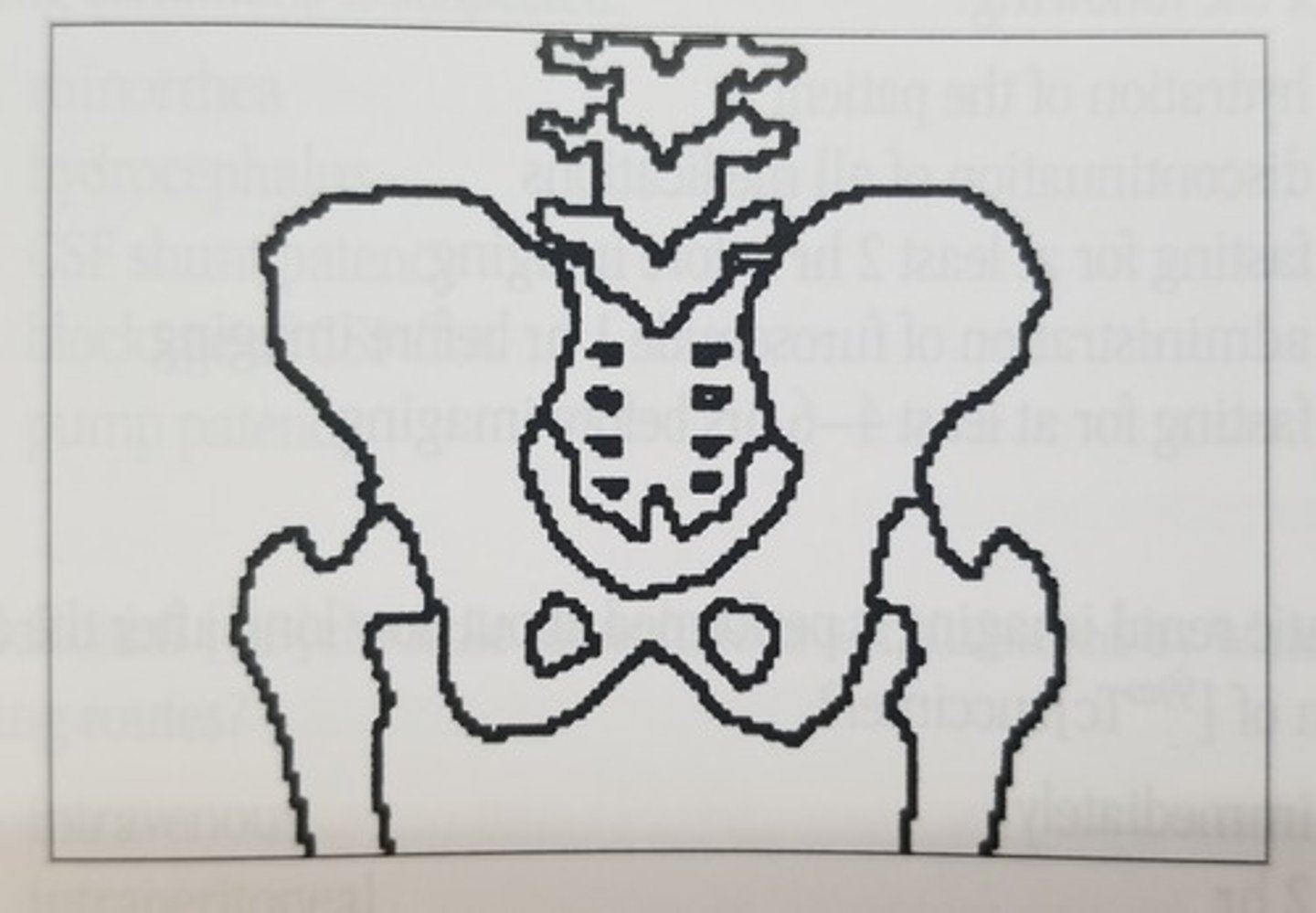 <p>- Ans:</p><p>- c. III</p><p>- The diagram depicts a posterior view of the lower lumbar spine, the pelvis, and the proximal femurs. The iliac crests would be demonstrated on an anterior view of the pelvis. The distal femurs and the tenth through twelfth thoracic vertebrae are inferior and superior, respectively, to the structures shown in the diagram.</p>