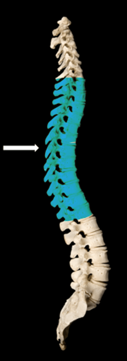 <p>name the vertebrae</p>