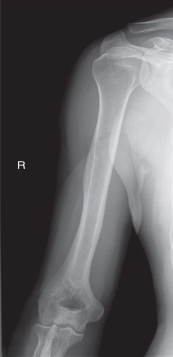 <p>name the position/projection</p>
