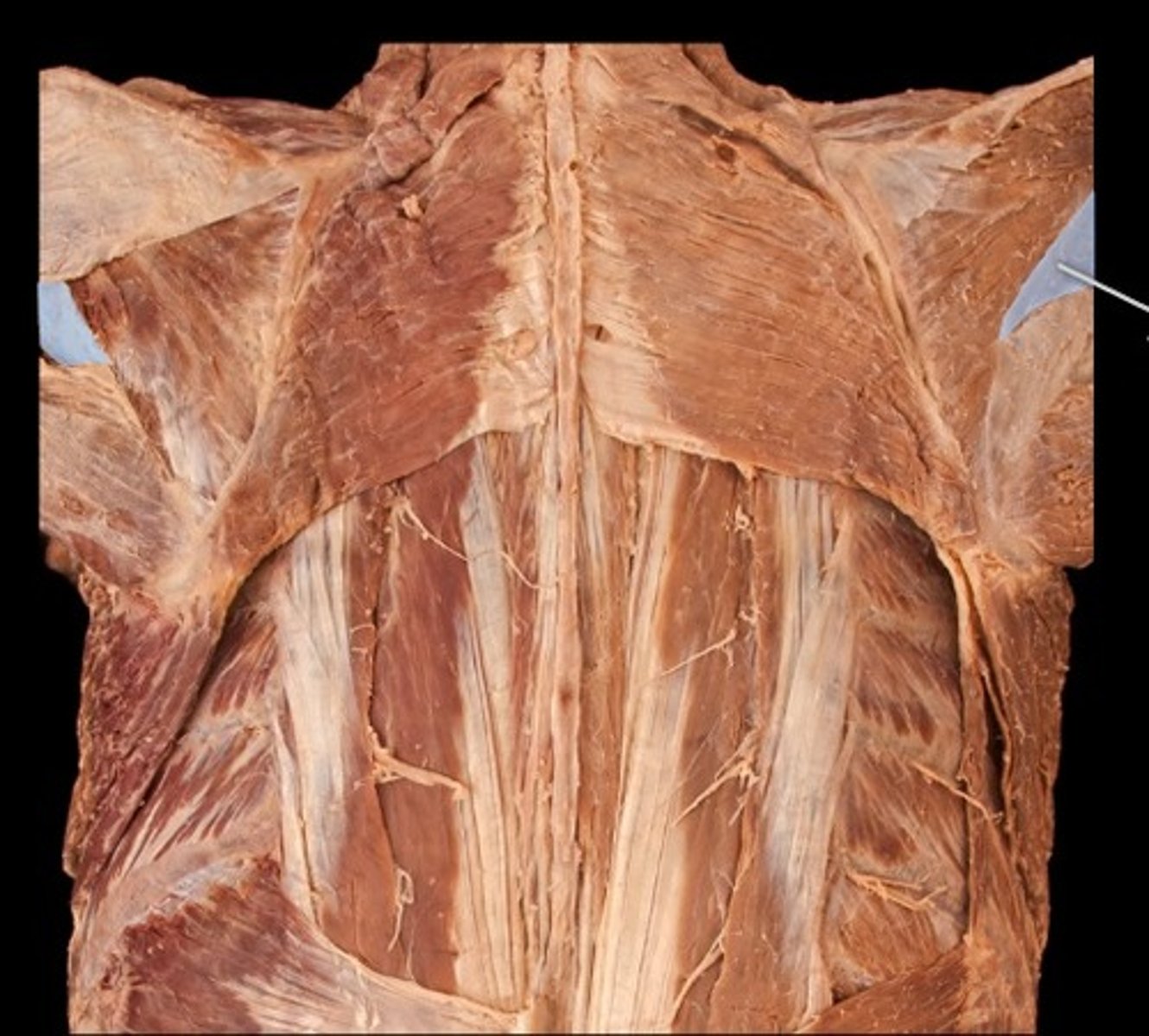<p>What muscle is this?</p>