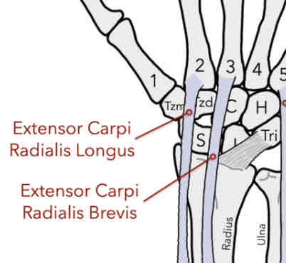 <p>• Extensor Carpi Radialis Brevis (ECRB)- muscle has insertion on the posterior side of the proximal base of the 3rd MC (middle finger)</p><p>-brevis: “short”</p><p>•Extensor Carpi Radialis Longus (ECRL)- muscle has an insertion on the posterior side of the proximal base of the 2nd MC (index finger)</p><p>-longus: “long”</p><p>-extension</p>