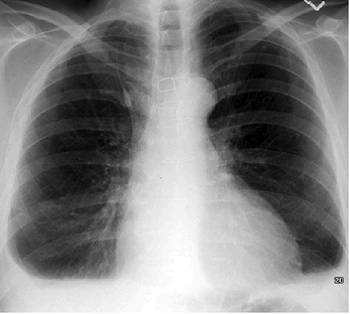<p>What is this pathology?</p>