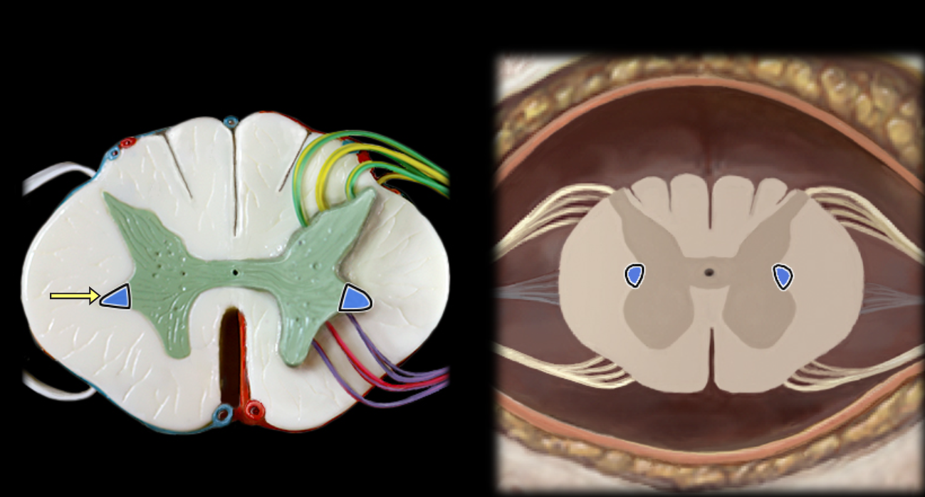 <p>Lateral horn of spinal cord</p>