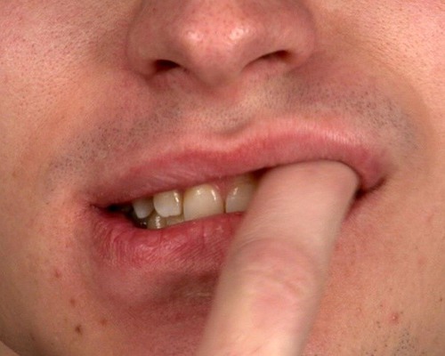 space between lips/cheeks and gums