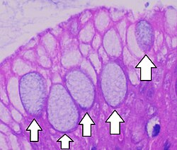 <p>Goblet cell</p>