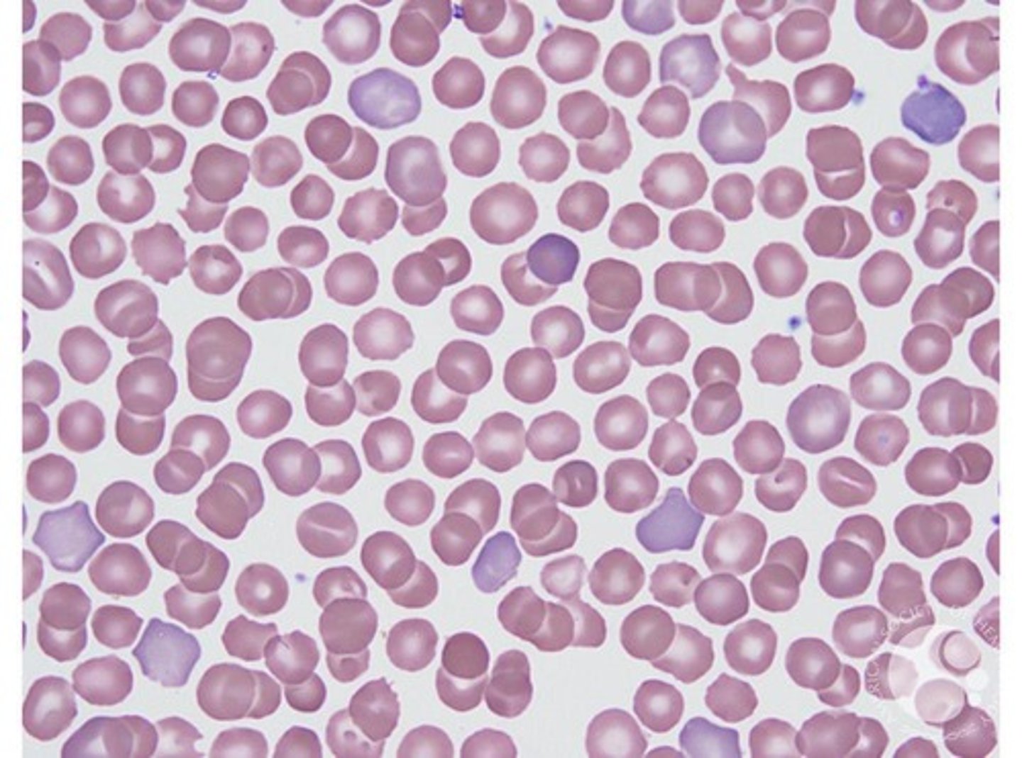 <p>Cells appear grey-blue in color due to residual RNA making it a premature RBC.</p>