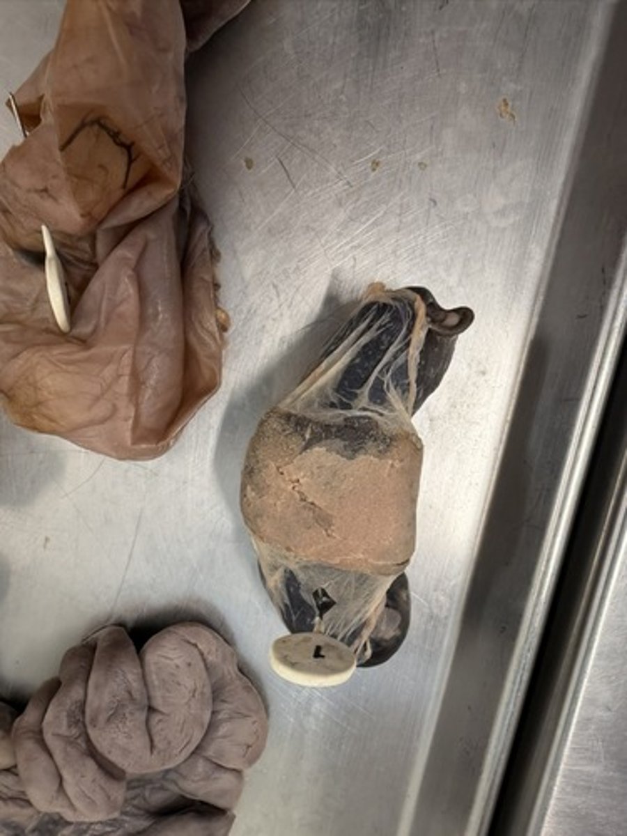 <p>A. ID the second placental layer the pin is passing through.</p><p>B. Classify the placenta type, based on chorionic attachment, of this animal.</p><p>C. What is the classification of placenta present based on the number of layers between</p><p>fetal and maternal blood?</p>