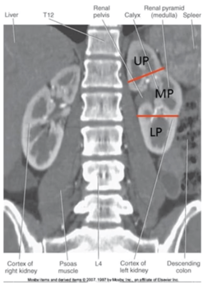 <p>30° LPO (Left Posterior Oblique) or RPO (Right Posterior Oblique).</p>