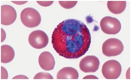 <ul><li><p>account for about 3 percent of all WBCs. </p></li><li><p>They have reddish-orange cytoplasmic granules </p></li><li><p>are involved in fighting parasitic infections </p></li><li><p>increased in number in people with acute or active <strong>allergies</strong>.</p></li></ul><p></p>