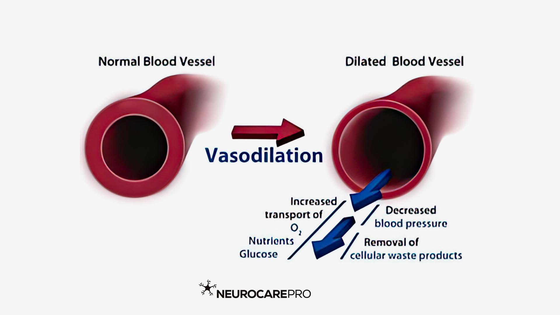 <ul><li><p>Vasodilation is the process where <strong>blood vessels widen</strong> due to the <strong>relaxation of smooth muscle</strong> in the vessel walls.</p></li><li><p><strong>Lowers blood pressure</strong> in turn <strong>increasing blood flow</strong>.</p></li></ul><p></p>