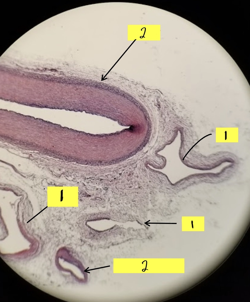 <p>what is #1 in this image?</p>