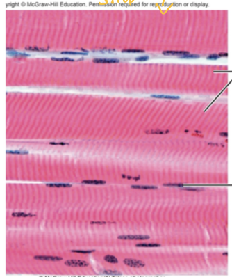 <p>What Muscle Tissue is this?</p>