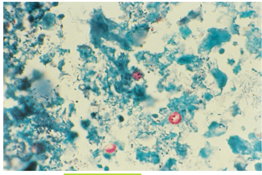 <p>A genus of parasitic coccidian protozoa.</p>