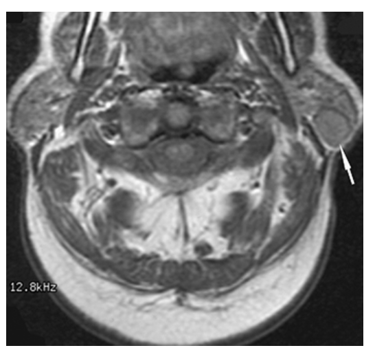 <p>What does the figure show?</p>