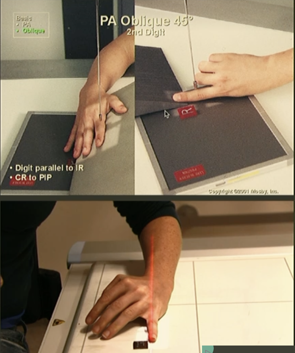 <p>Fine FS, 100cm</p><p>55kVp/1mAs</p><p>Straight tube</p><p>CR: Distal portion of proximal phalanx</p>