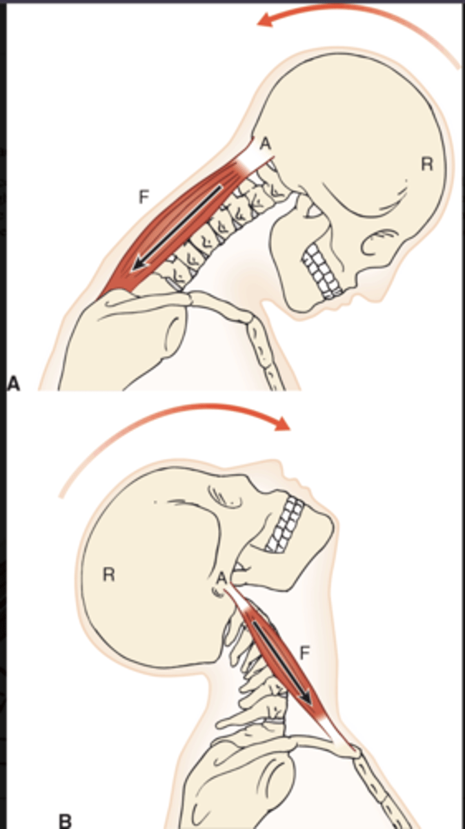 <p>Neck/atlanto-occipital joint balancing the head.</p>