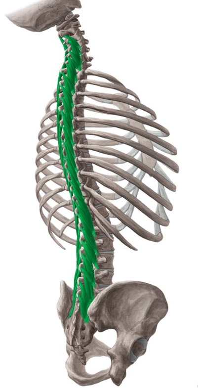 <p>Multifidus insertion</p>