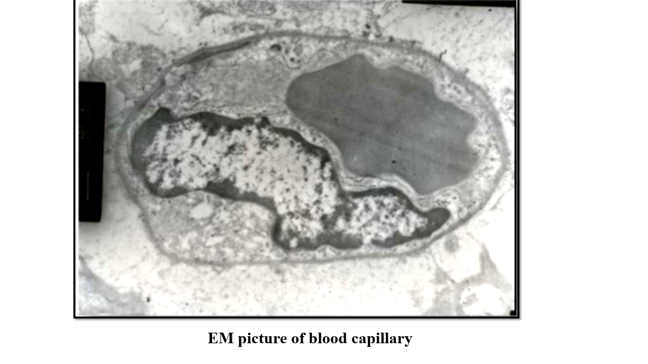 <p>Term 35</p>