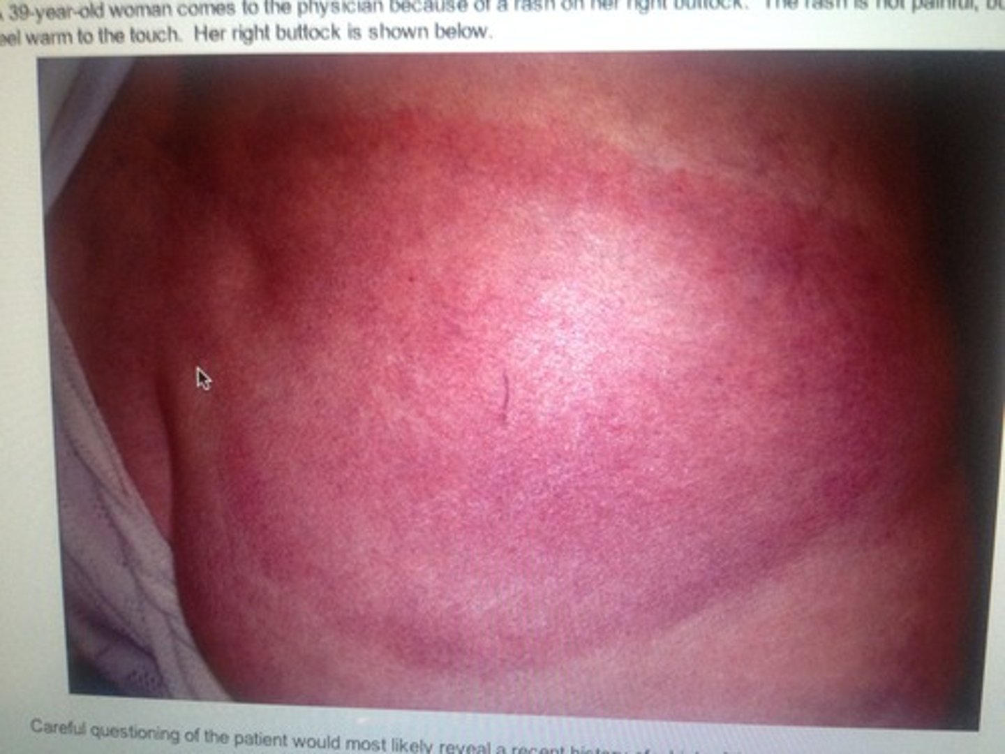 <p>ID whose ass this is</p>