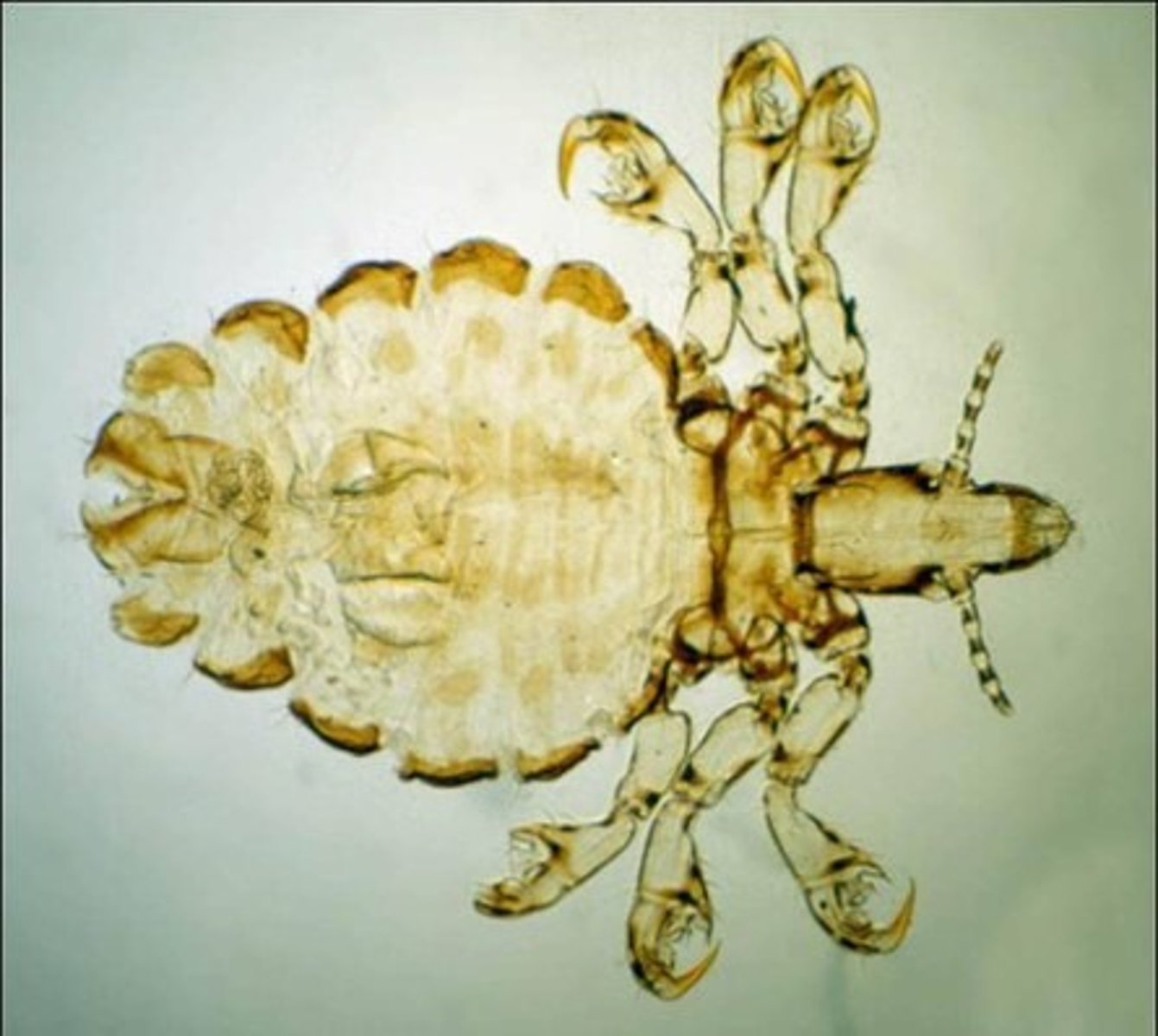 <p>This was found on an anemic pig. What is it?</p>