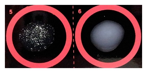 <ul><li><p>Antigen test</p></li><li><p>Qualitative</p><ol><li><p>Latex particles are coated with antibodies specific to that fungi</p></li><li><p>Take samples from the patient</p></li><li><p>When the fungus’ antigen interacts with the anti-bodies it causes clumping (agglutination)</p></li></ol></li></ul><p></p>