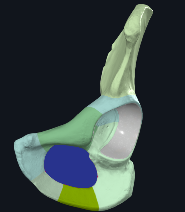 <p>What is highlighted blue</p>